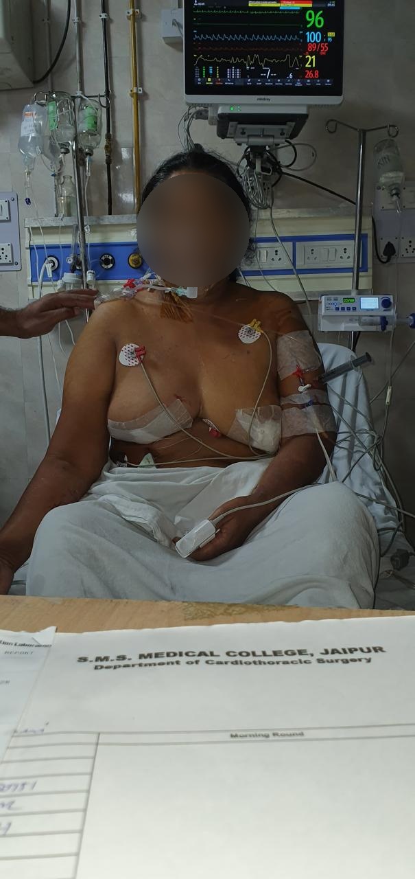 MVR - Mitral Valve Replacement surgical photo