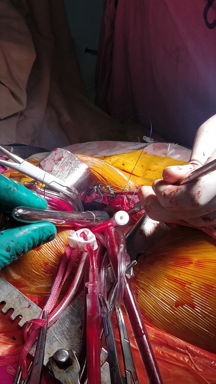 Unique Surgical Procedures surgical photo