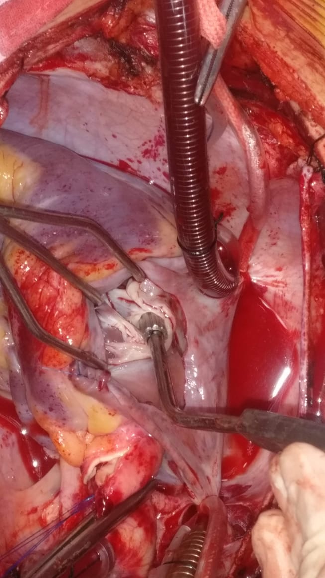 Unique Surgical Procedures surgical photo