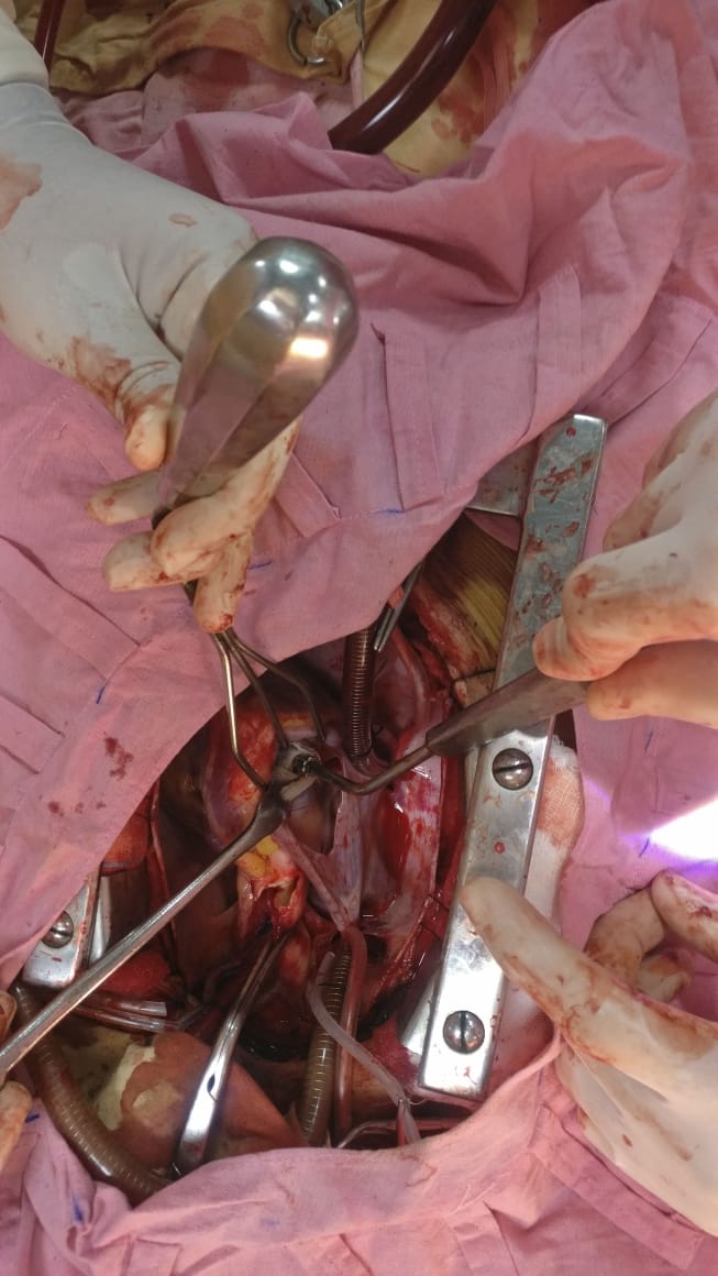 Unique Surgical Procedures surgical photo