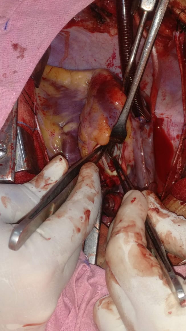 Unique Surgical Procedures surgical photo