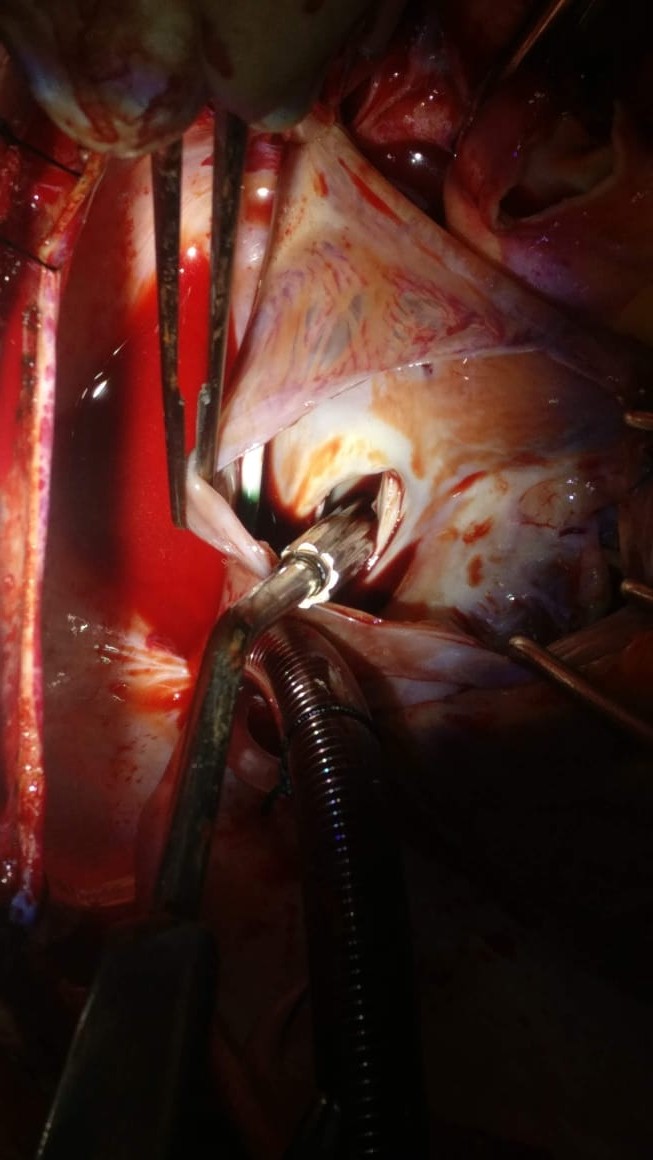 Unique Surgical Procedures surgical photo