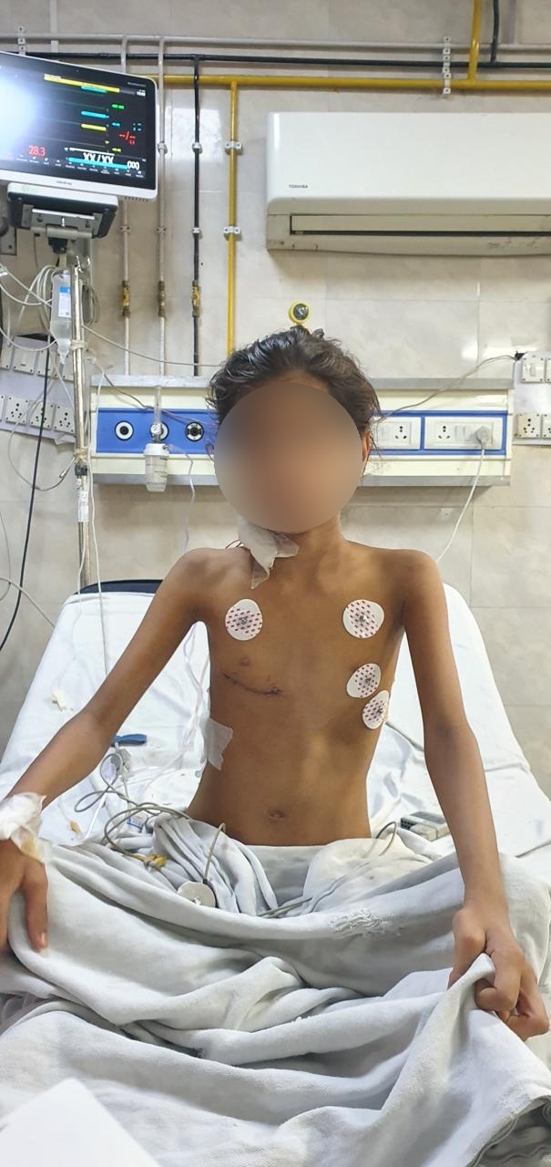 VSD - Ventricular Septal Defect surgical photo