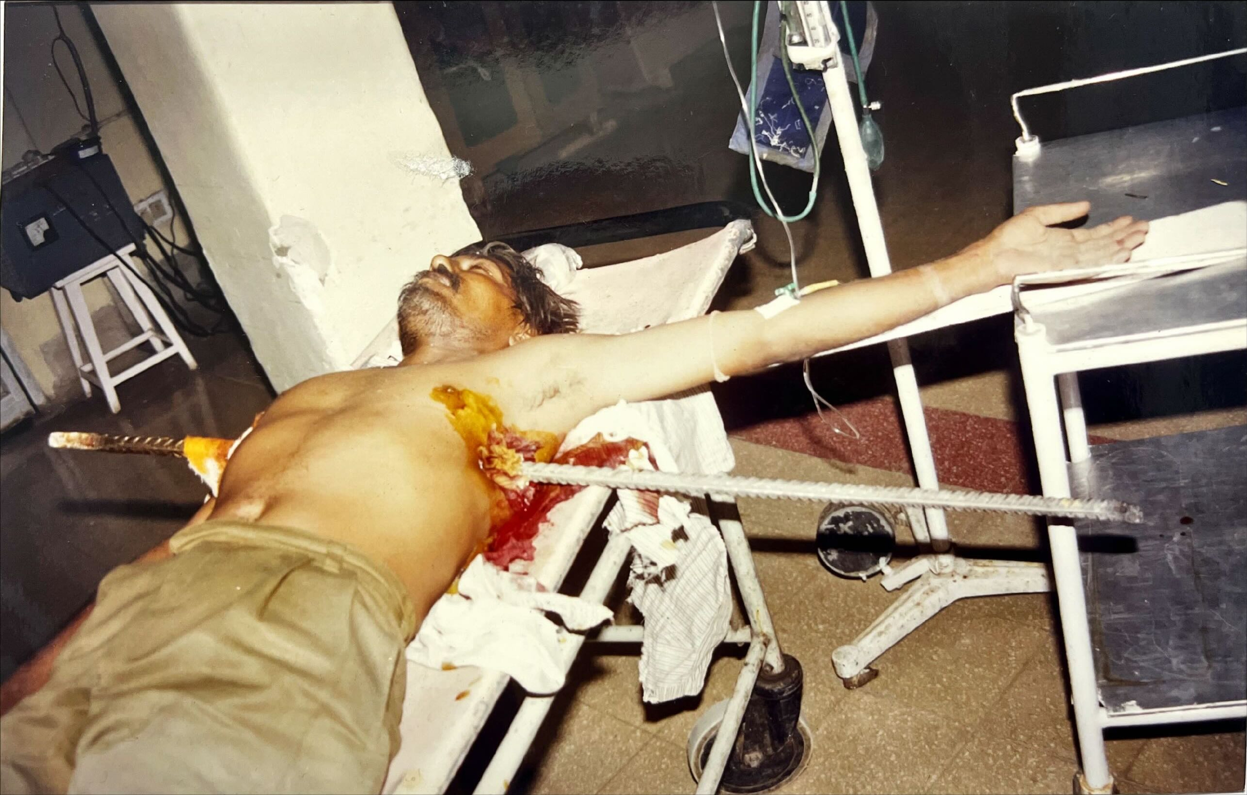 Featured & Complex Cases surgical photo